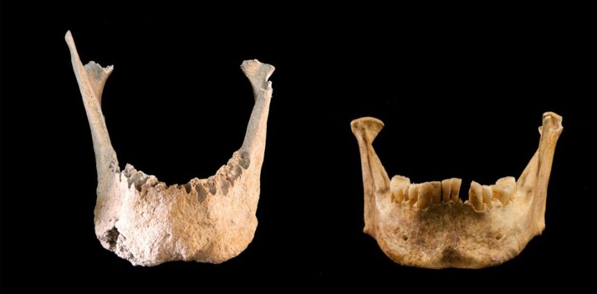 mandibula-gigante