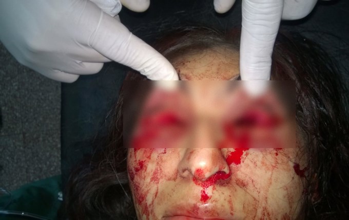 argentina-joven violada rito satanico