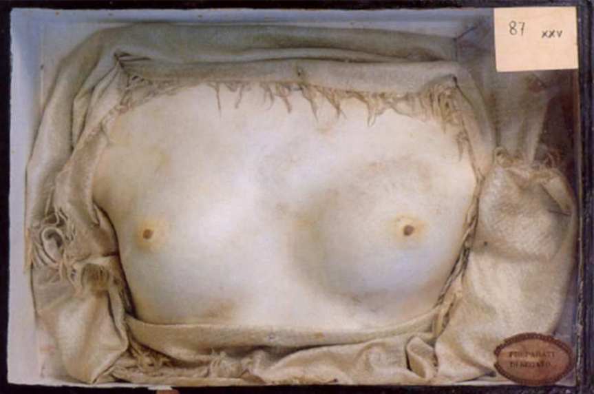 Segato_Busto_pietrificato